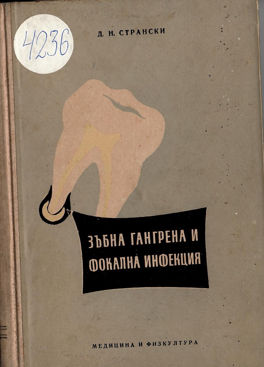  Зъбна гангрена и фокална инфекция