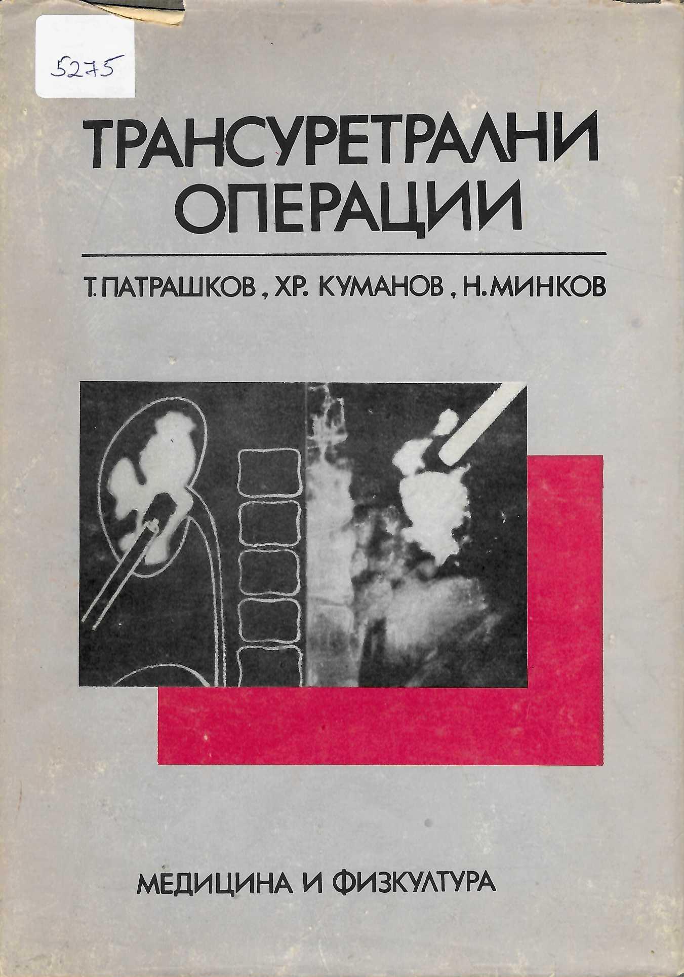   Трансуретрални операции